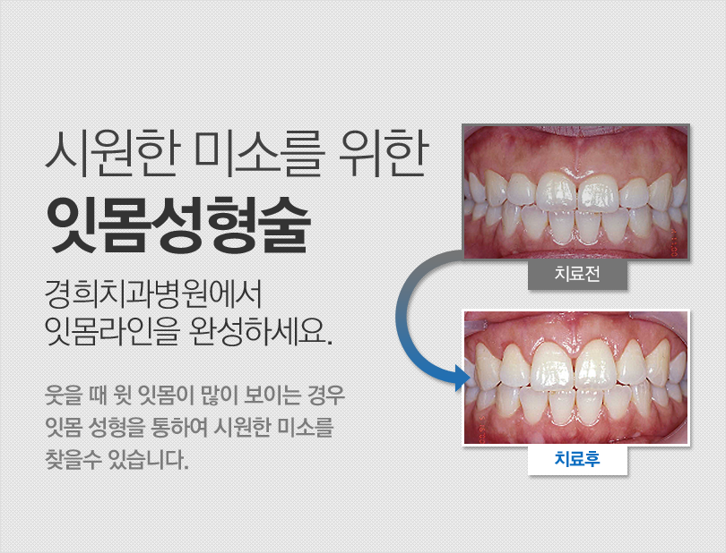 치아교정 실력과 노하우